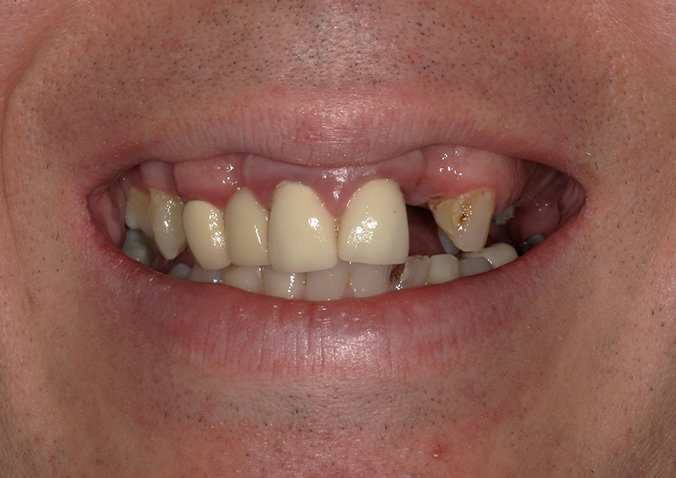 Before - Fusion Dental