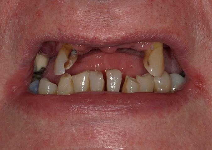 Before - Fusion Dental